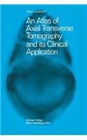 An Atlas of Axial Transverse Tomography and Its Clinical Application