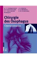 Chirurgie Des Ösophagus
