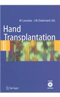 Hand transplantation