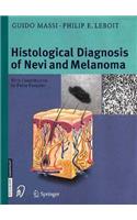 The Histological Diagnosis of Nevi and Melanoma
