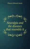 Neuralgia and the diseases that resemble it