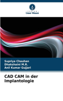 CAD CAM in der Implantologie