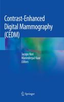 Contrast-Enhanced Digital Mammography (Cedm)