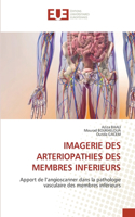 Imagerie Des Arteriopathies Des Membres Inferieurs