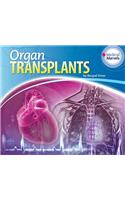 Organ Transplants