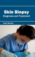 Skin Biopsy: Diagnosis and Treatment
