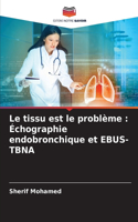 tissu est le problème