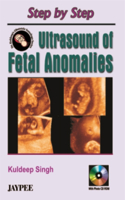 Step by Step Ultrasound of Fetal Anomalies