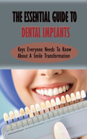 The Essential Guide To Dental Implants: Keys Everyone Needs To Know About A Smile Transformation: Overview Of Current Knowledge And Suggestions For Dental Implants Planning