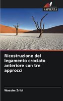Ricostruzione del legamento crociato anteriore con tre approcci