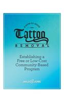 Tattoo Removal