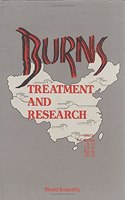 Burns: Treatment and Research