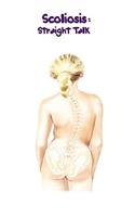Scoliosis: Straight Talk