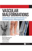 Vascular Malformations