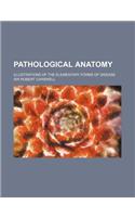 Pathological Anatomy; Illustrations of the Elementary Forms of Disease