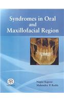 Syndromes In Oral And Maxillofacial Region (Pb)