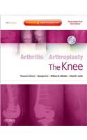 The Knee [With DVD]