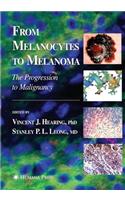 From Melanocytes to Melanoma