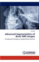 Advanced Segmentation of Brain MRI Images