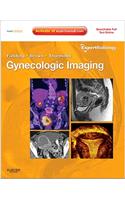 Gynecologic Imaging: Expert Radiology Series (Expert Consult Premium Edition - Enhanced Online Features and Print)