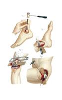 Resections Performed on the Lower Extremity Notebook