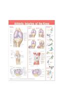 Athletic Injuries of the Knee Anatomical Chart