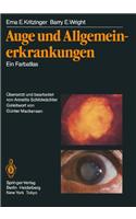 Auge und Allgemeinerkrankungen