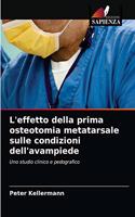 L'effetto della prima osteotomia metatarsale sulle condizioni dell'avampiede