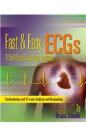 Fast & Easy ECGs