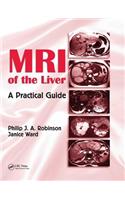 MRI of the Liver