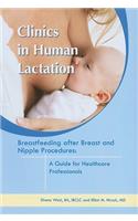 Breastfeeding After Breast and Nipple Procedures