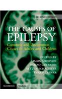 Causes of Epilepsy