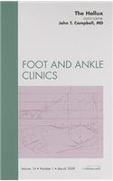 Hallux, an Issue of Foot and Ankle Clinics: Volume 14-1