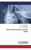 Giant Cell Lesions of the Jaws