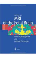 MRI of the Fetal Brain