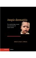 Atopic Dermatitis: The Epidemiology, Causes and Prevention of Atopic Eczema