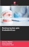 Restaurações pós Endodônticas