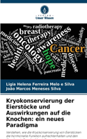 Kryokonservierung der Eierstöcke und Auswirkungen auf die Knochen: ein neues Paradigma