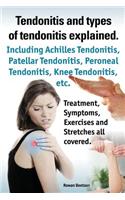 Tendonitis and the Different Types of Tendonitis Explained. Tendonitis Symptoms, Diagnosis, Treatment Options, Stretches and Exercises All Included.