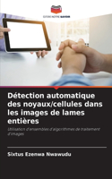 Détection automatique des noyaux/cellules dans les images de lames entières