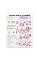 Understanding Leukemia Anatomical Chart