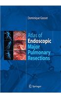 Atlas of endoscopic major pulmonary resections