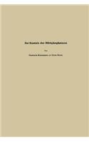 Zur Kenntnis Der Milchphosphatasen