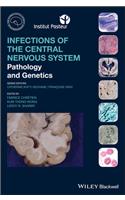 Infections of the Central Nervous System