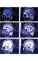 Brain Movies