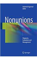 Nonunions