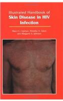 Illustrated Handbook of Skin Disease in HIV Infection
