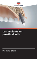 Les implants en prosthodontie