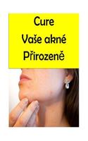 Cure Your Acne Naturally (Czech)