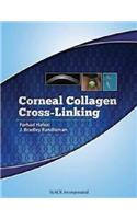 Corneal Collagen Cross Linking